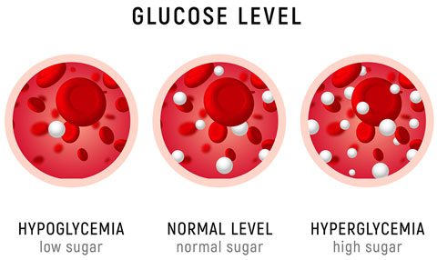 Glucose Blood Level Hypoglycemia Normal level
