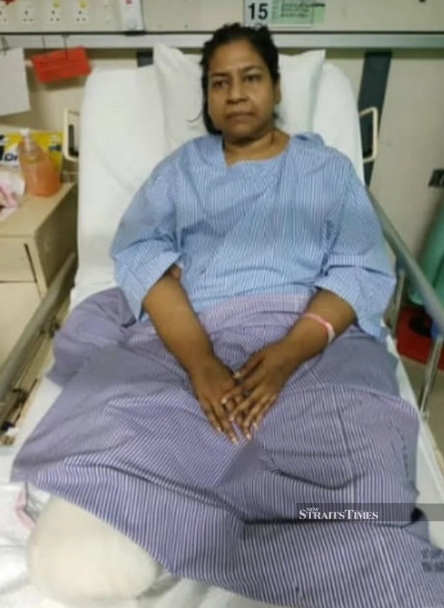  After her amputation.