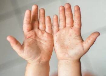 Image Source: SBCC Baby and Child Clinic