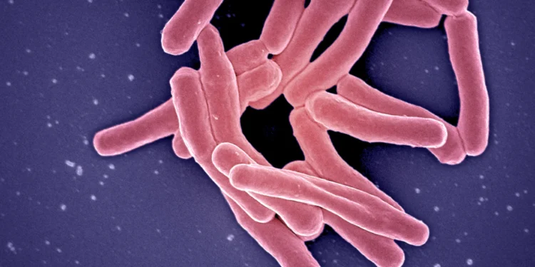 Image Source: Wikimedia Commons